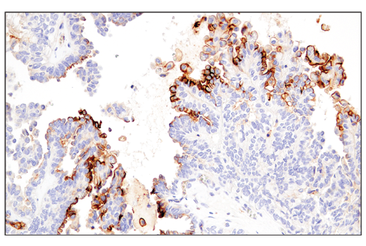 Immunohistochemistry Image 2: CD54/ICAM-1 (E3Q9N) Rabbit Monoclonal Antibody (BSA and Azide Free)