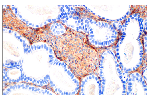 Immunohistochemistry Image 1: BST2 (E4N3W) Rabbit Monoclonal Antibody