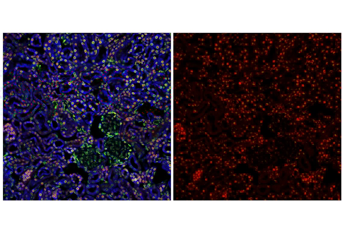 Immunofluorescence Image 2: p300 (E6D1T) Rabbit Monoclonal Antibody (BSA and Azide Free)