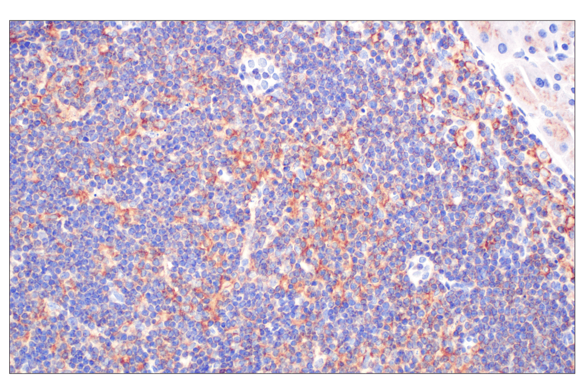 Immunohistochemistry Image 4: CCL3/MIP-1 alpha (F2M8Q) Rabbit Monoclonal Antibody