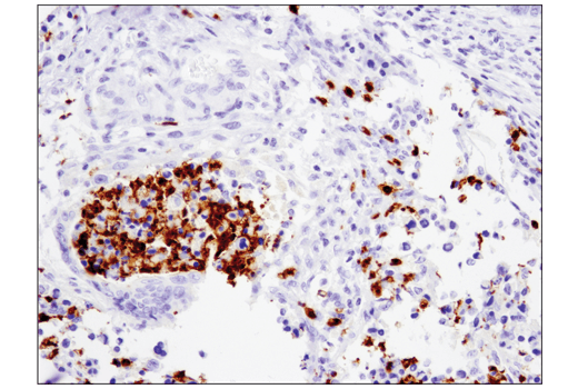 Immunohistochemistry Image 1: Arginase-1 (D4E3M) Rabbit Monoclonal Antibody (BSA and Azide Free)
