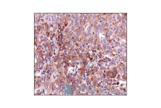 Immunohistochemistry Image 7: Phospho-S6 Ribosomal Protein (Ser235/236) Antibody