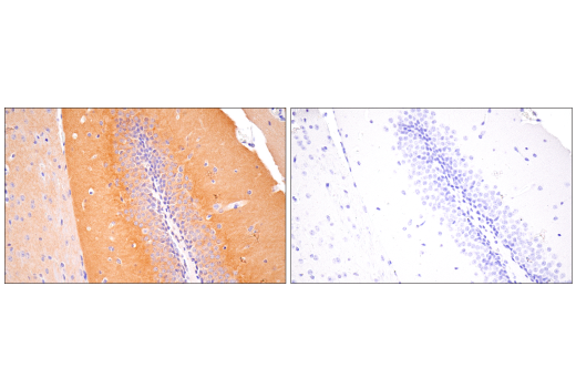 Immunohistochemistry Image 4: SynGAP-alpha2 (E4Y6I) Rabbit Monoclonal Antibody