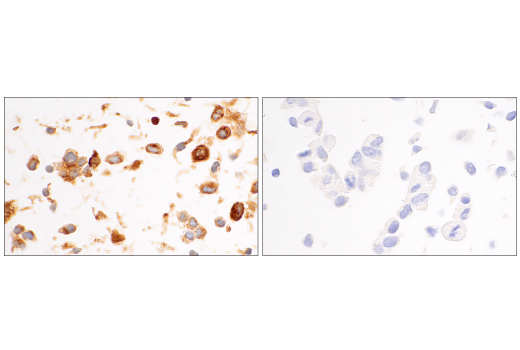 Immunohistochemistry Image 8: PAI-1 (E3I5H) Rabbit Monoclonal Antibody