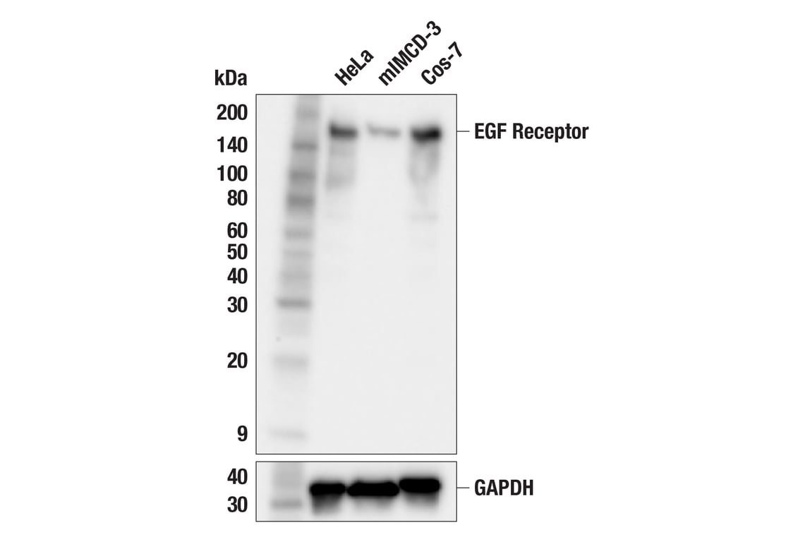 Western Blotting Image 3: EGF Receptor (D38B1) Rabbit Monoclonal Antibody