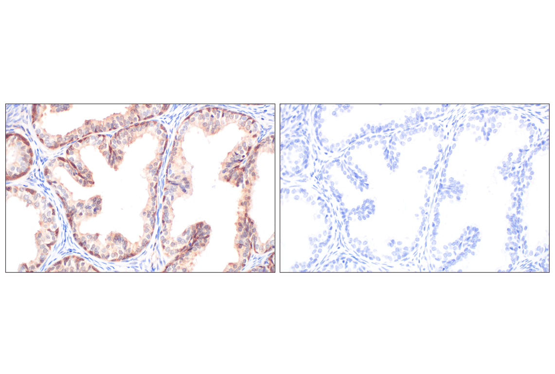 Immunohistochemistry Image 11: Galectin-8/LGALS8 (F9O3T) Rabbit Monoclonal Antibody
