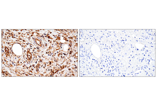 Immunohistochemistry Image 5: Tapasin (E6P2Z) Rabbit Monoclonal Antibody (BSA and Azide Free)