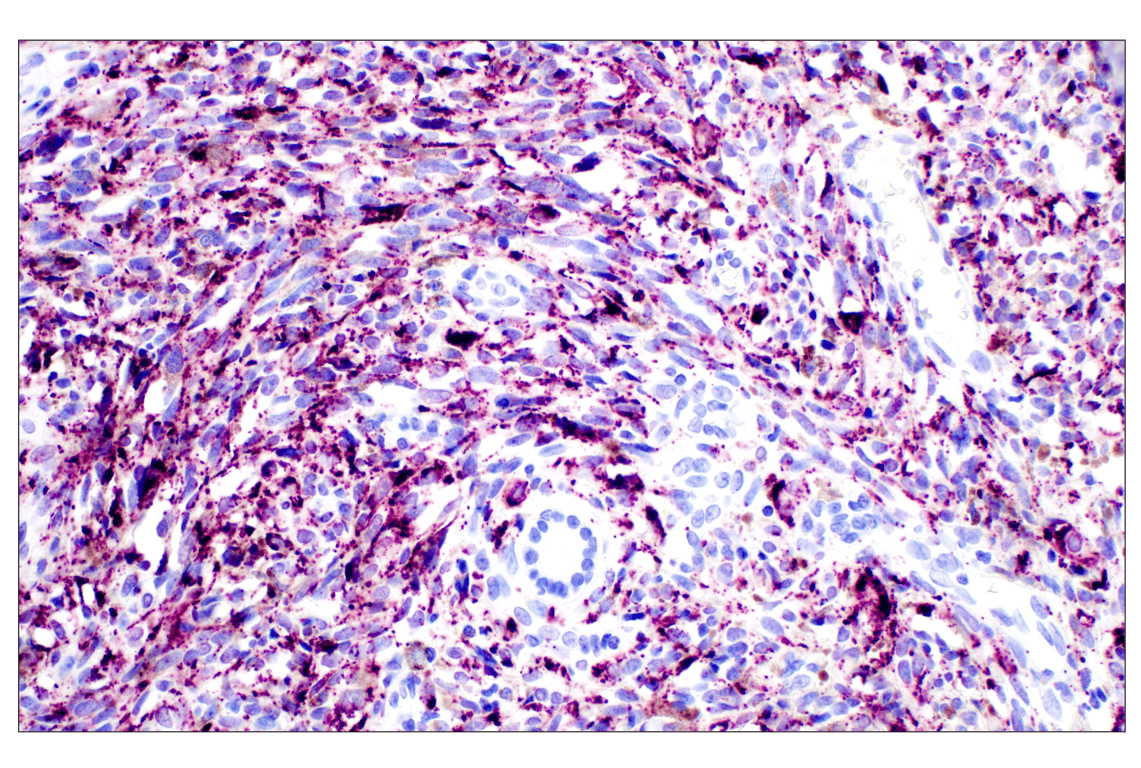 Immunohistochemistry Image 8: Perilipin-2 (E6G6M) Rabbit Monoclonal Antibody