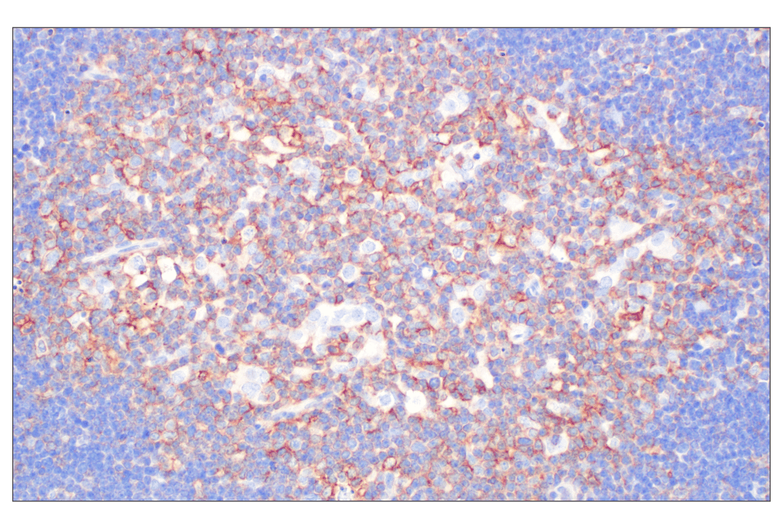 Immunohistochemistry Image 3: CCL3/MIP-1 alpha (F2M8Q) Rabbit Monoclonal Antibody