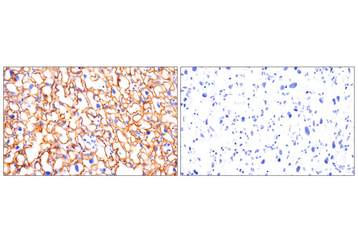 Immunohistochemistry Image 4: Angiomotin (F7W8U) Rabbit Monoclonal Antibody