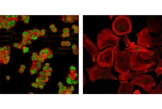 Immunofluorescence Image 1: GATA-6 (D61E4) Rabbit Monoclonal Antibody