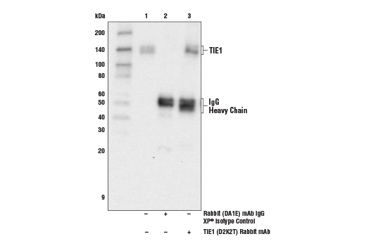 Immunoprecipitation Image 1: TIE1 (D2K2T) Rabbit Monoclonal Antibody