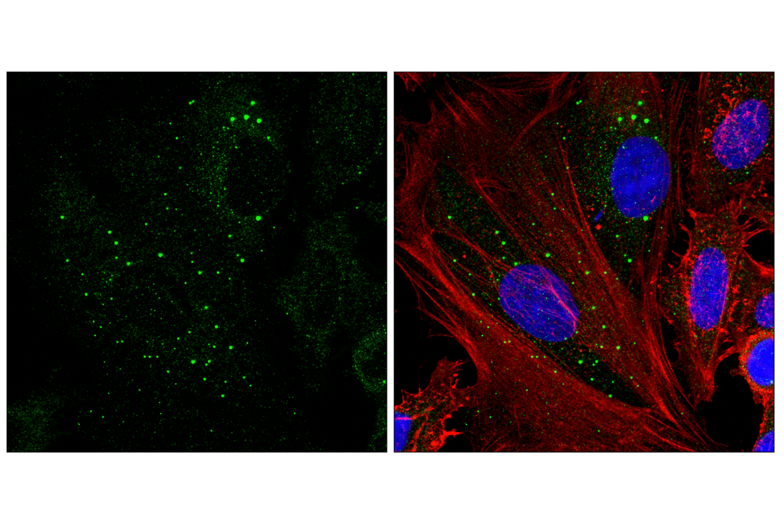 Immunofluorescence Image 1: DDX6/RCK Antibody