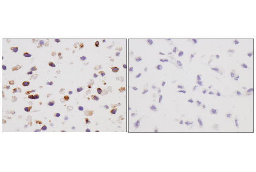Immunohistochemistry Image 4: VISTA (D5L5T) Rabbit Monoclonal Antibody (BSA and Azide Free)