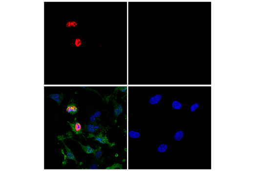 Immunofluorescence Image 2: TUNEL Assay Kit (Fluorescence, 594 nm)