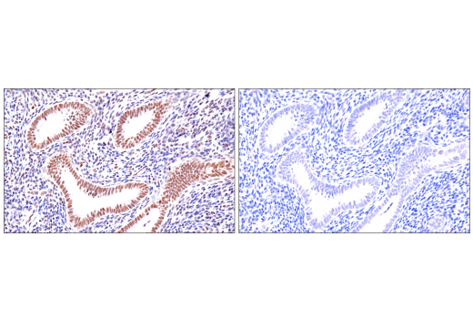 Immunohistochemistry Image 10: ATRX (E5X7O) Rabbit Monoclonal Antibody