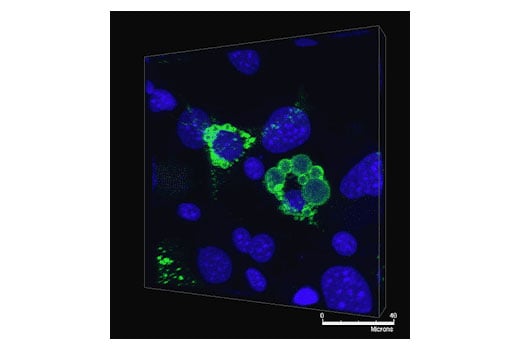 Immunofluorescence Image 1: Perilipin-1 (D1D8) Rabbit Monoclonal Antibody