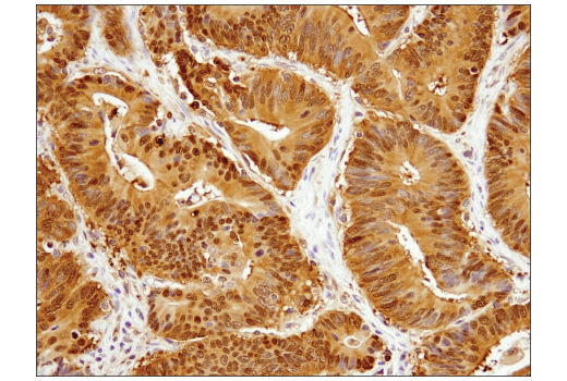 Immunohistochemistry Image 5: Stat3 (D1B2J) Rabbit Monoclonal Antibody (BSA and Azide Free)