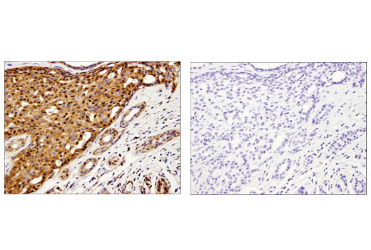 Immunohistochemistry Image 4: Galectin-1/LGALS1 (D608T) Rabbit Monoclonal Antibody (IHC Formulated)