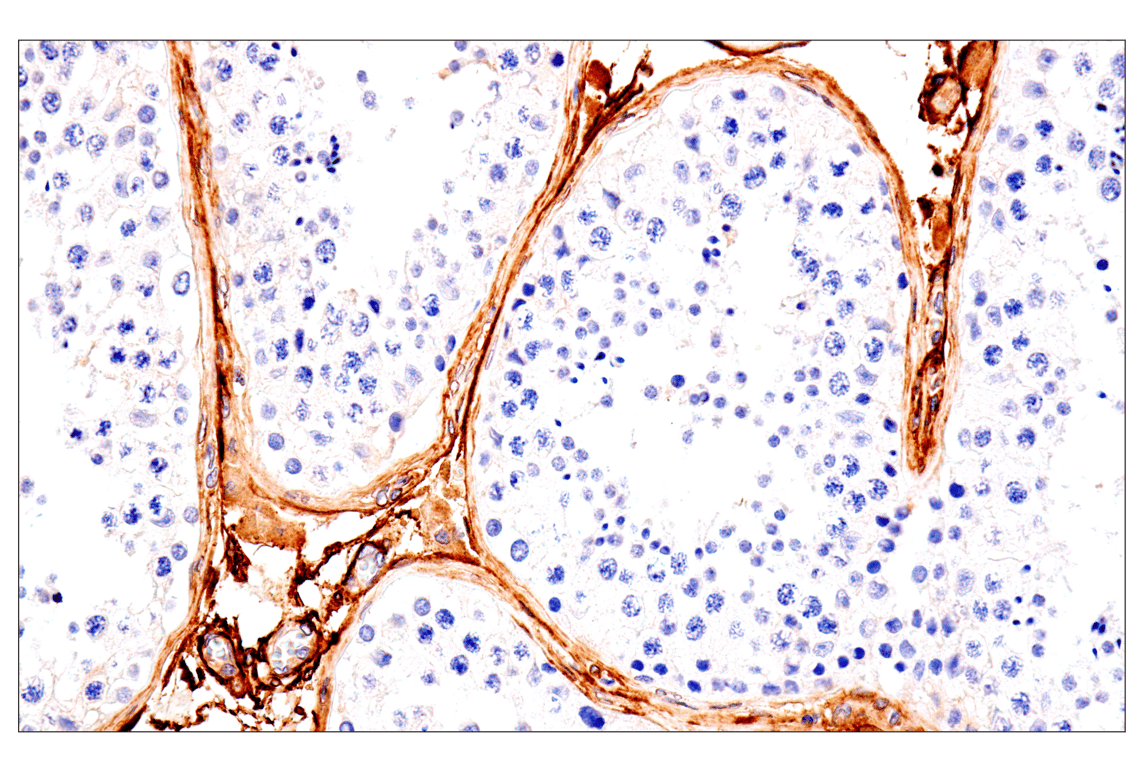 Immunohistochemistry Image 7: p75NTR (E7I3M) Rabbit Monoclonal Antibody (BSA and Azide Free)
