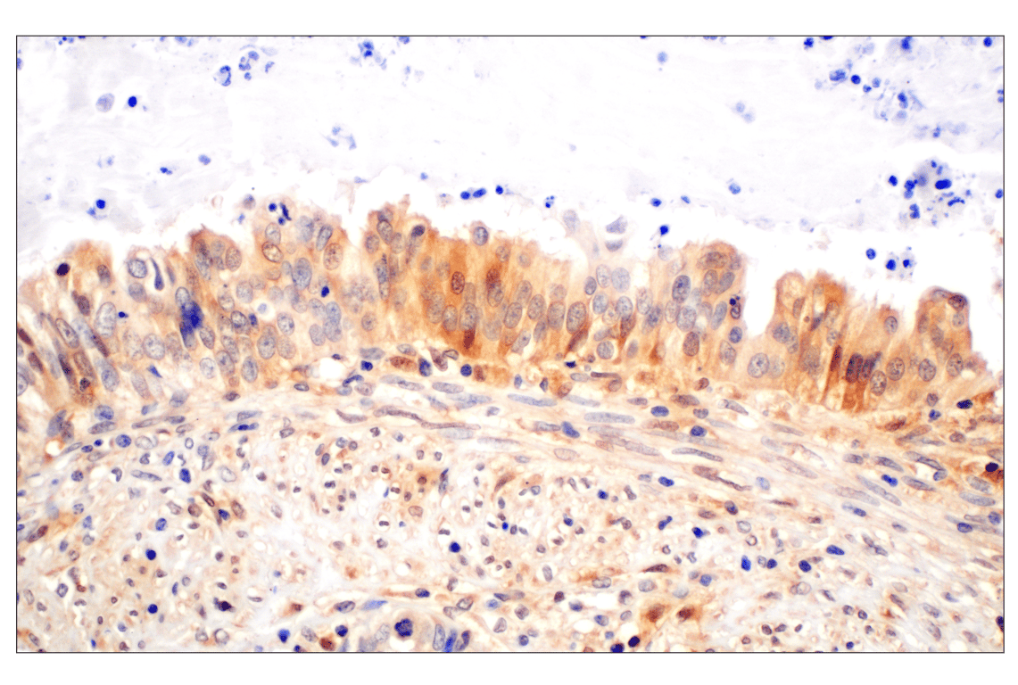 Immunohistochemistry Image 4: Galectin-8/LGALS8 (F9O3T) Rabbit Monoclonal Antibody