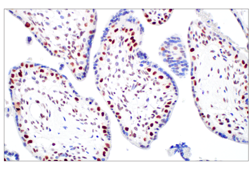 Immunohistochemistry Image 9: TIF1 alpha/TRIM24 (E9T3N) Rabbit Monoclonal Antibody