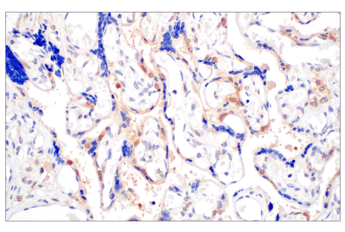 Immunohistochemistry Image 9: Galectin-8/LGALS8 (F9O3T) Rabbit Monoclonal Antibody