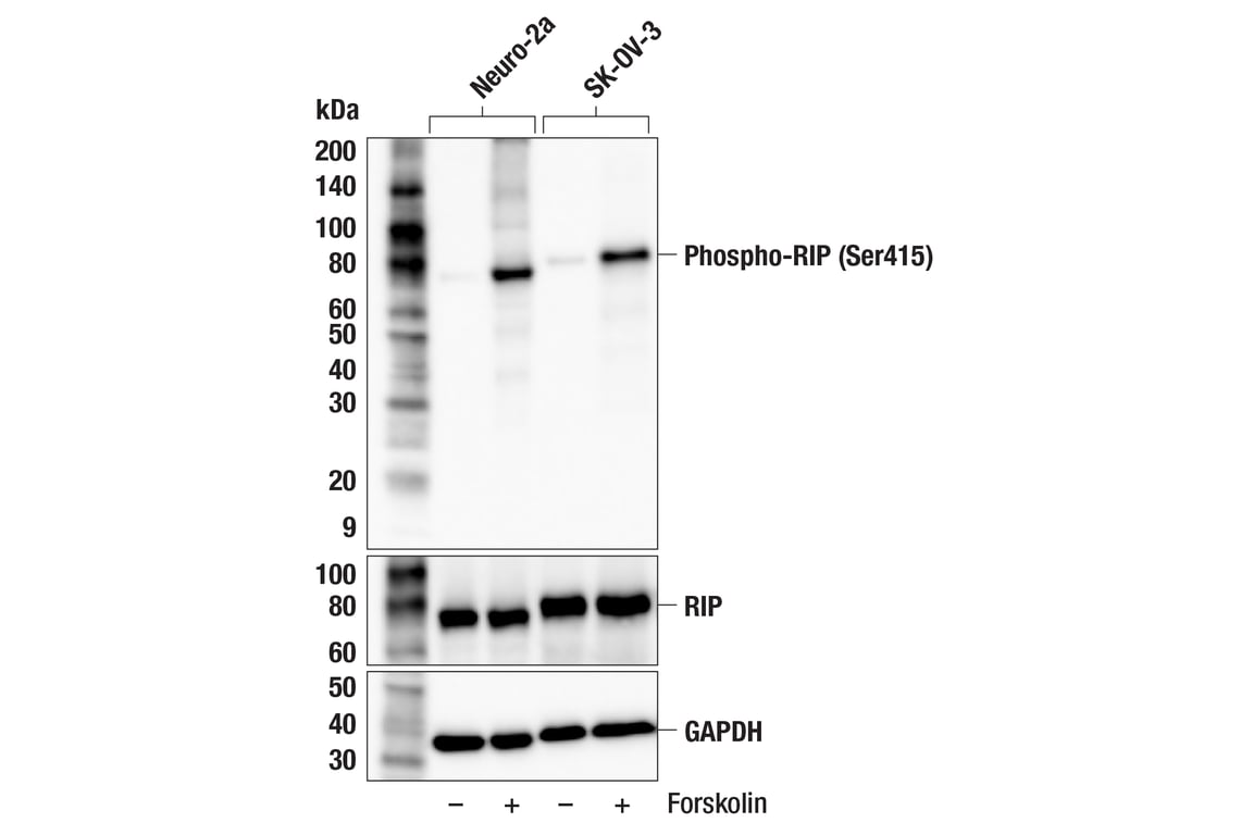 Western Blotting Image 2: Phospho-RIP (Ser415) (F1U7B) Rabbit Monoclonal Antibody