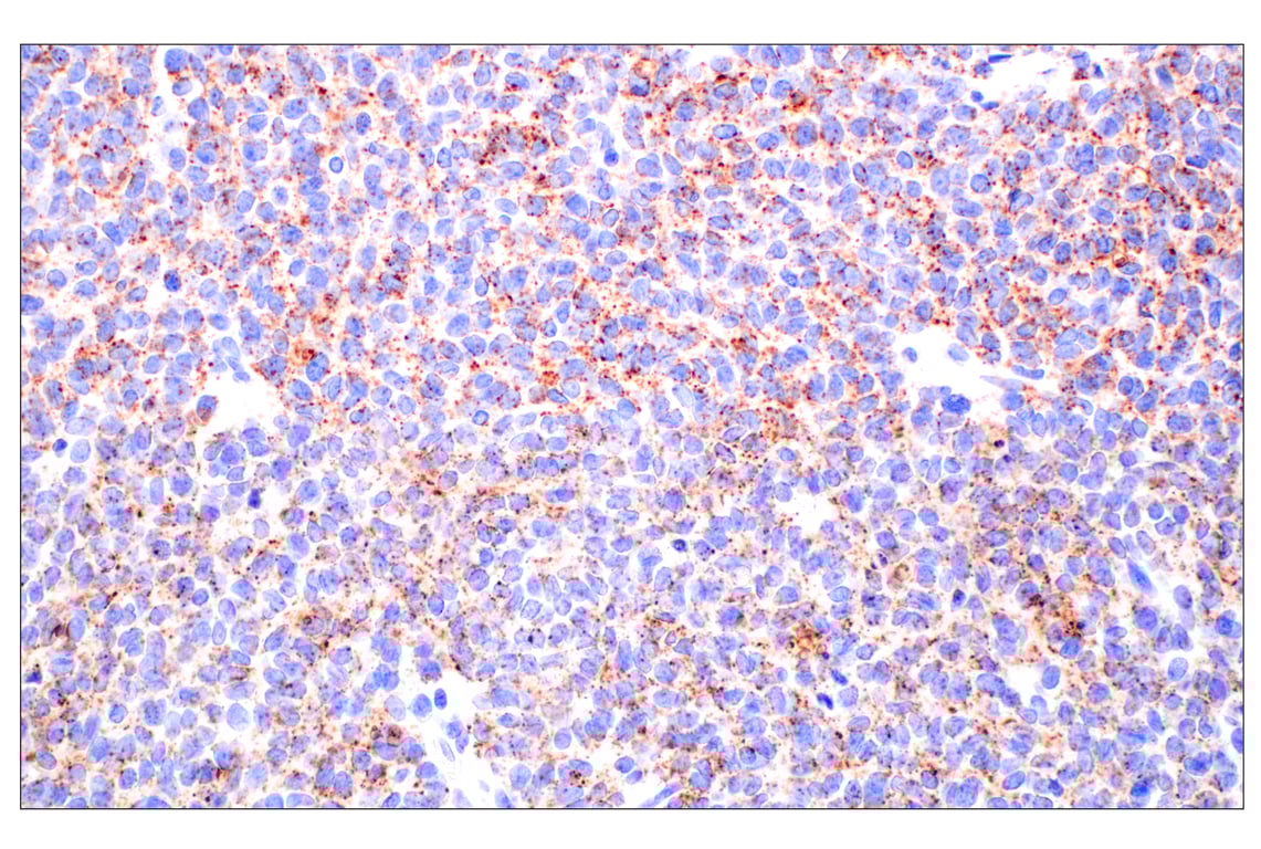 Immunohistochemistry Image 2: NPC1 (E7S4N) Rabbit Monoclonal Antibody