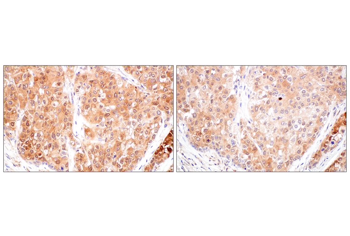 Immunohistochemistry Image 9: SerpinB1 (E4W7B) Rabbit Monoclonal Antibody