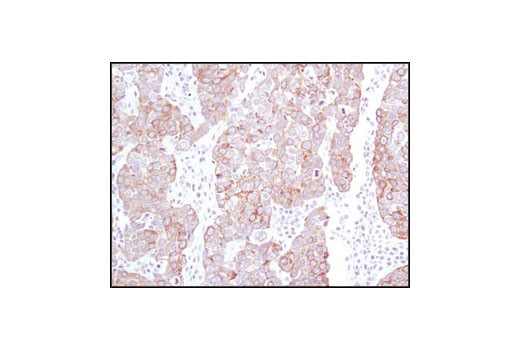 undefined Image 13: Cytokeratin Antibody Sampler Kit