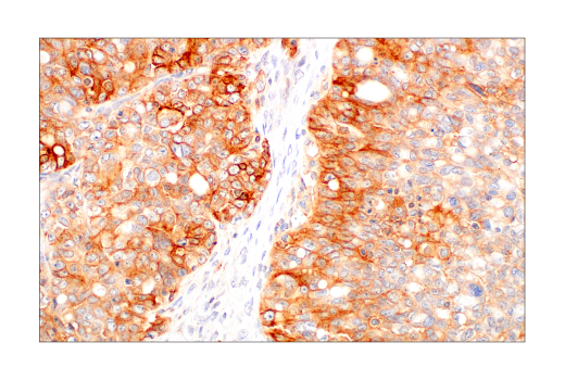 Immunohistochemistry Image 11: CMTM6 (E6A8T) Rabbit Monoclonal Antibody