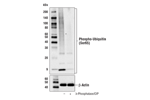 Western Blotting Image 2: Phospho-Ubiquitin (Ser65) (E2J6T) Rabbit Monoclonal Antibody (BSA and Azide Free)