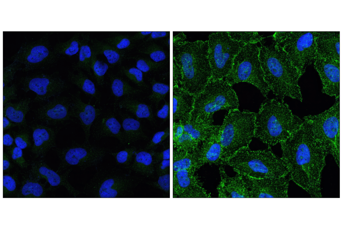 Immunofluorescence Image 1: Phospho-EGF Receptor (Tyr1068) (D7A5) Rabbit Monoclonal Antibody (BSA and Azide Free)