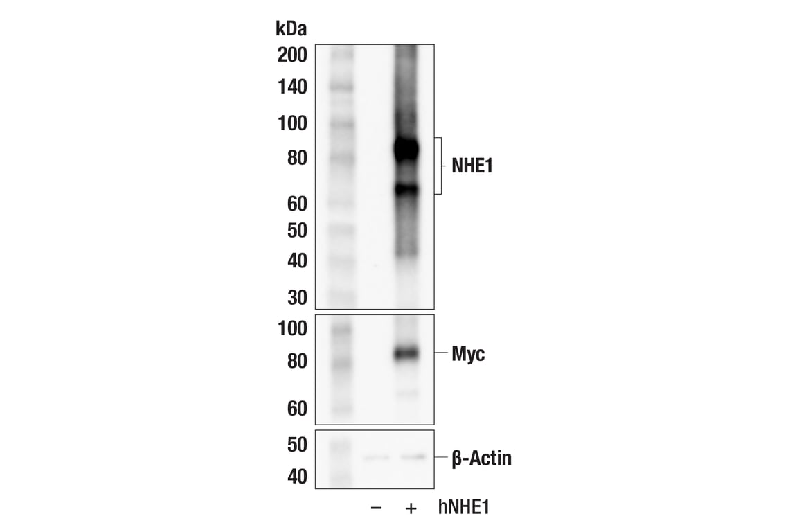 Western Blotting Image 3: NHE1 (E2S8S) Rabbit Monoclonal Antibody