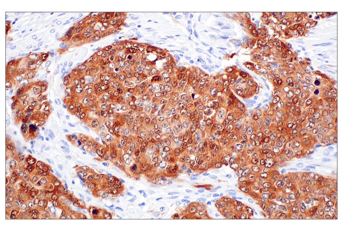 Immunohistochemistry Image 1: p16 INK4A (F9T1L) Rabbit Monoclonal Antibody