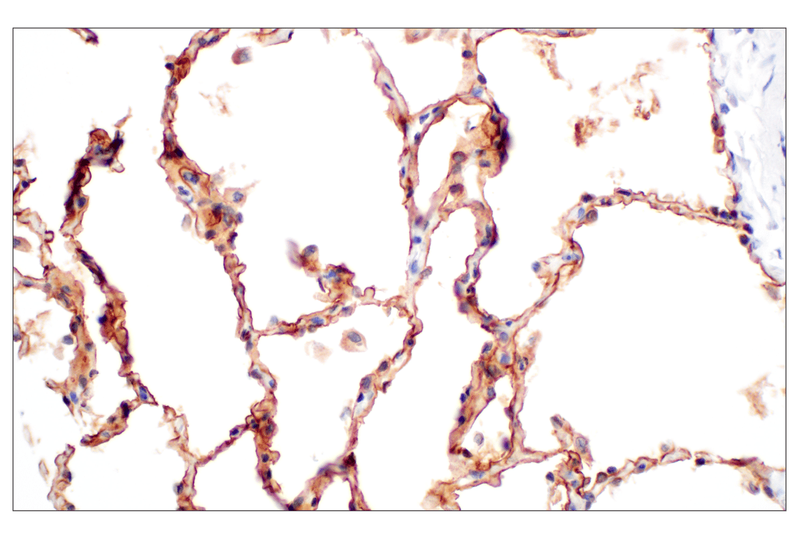 Immunohistochemistry Image 4: Folate Receptor Alpha/FOLR1 (E8U2F) Mouse Monoclonal Antibody