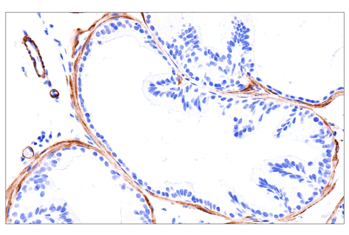 Immunohistochemistry Image 13: MYH11 (E4N8M) Rabbit Monoclonal Antibody (BSA and Azide Free)