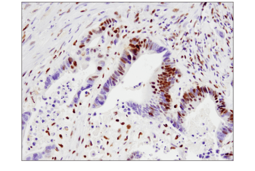 Immunohistochemistry Image 1: SLFN11 (D8W1B) Rabbit Monoclonal Antibody
