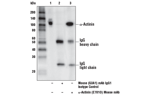 Immunoprecipitation Image 1: alpha-Actinin (E7U1O) Mouse Monoclonal Antibody
