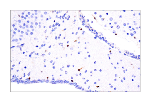 undefined Image 25: Mouse Reactive Inflammasome Antibody Sampler Kit