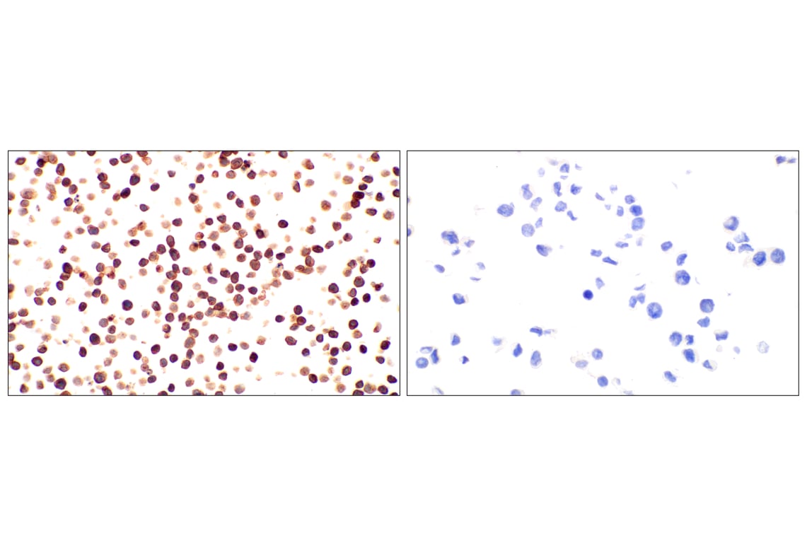 Immunohistochemistry Image 8: IgM (E8M1B) Rabbit Monoclonal Antibody (BSA and Azide Free)