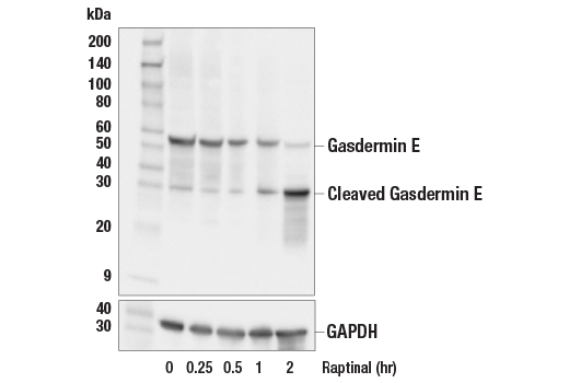 undefined Image 1: Gasdermin Family Antibody Sampler Kit