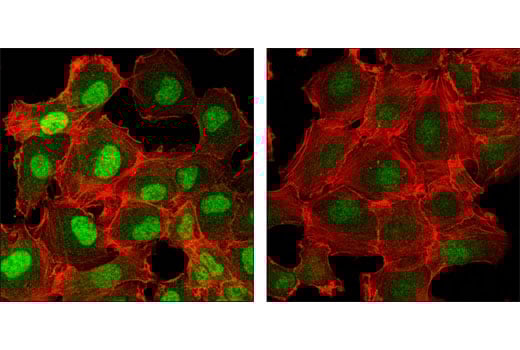Immunofluorescence Image 2: Phospho-SMAD1/5 (Ser463/465) (41D10) Rabbit Monoclonal Antibody (BSA and Azide Free)