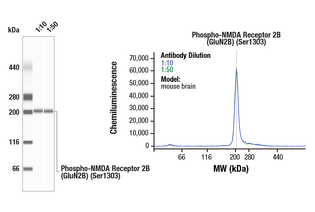 Western Blotting Image 1: Phospho-NMDA Receptor 2B (GluN2B) (Ser1303) (E3E9I) Rabbit Monoclonal Antibody