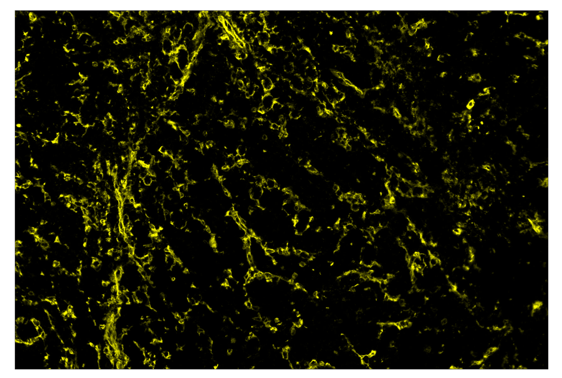 Immunohistochemistry Image 3: CD39/NTPDase 1 (E2X6B) & CO-0076-647 SignalStar<sup>™</sup> Oligo-Antibody Pair