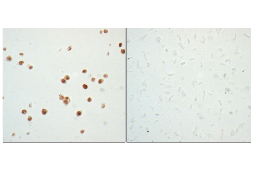 Immunohistochemistry Image 3: p53 (7F5) Rabbit Monoclonal Antibody (BSA and Azide Free)