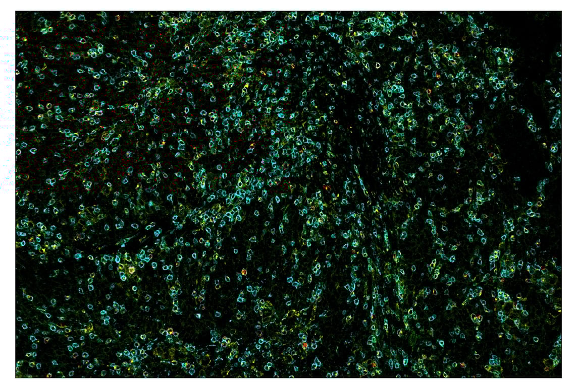 Immunohistochemistry Image 7: LAG3 (D2G4O) & CO-0026-647 SignalStar<sup>®</sup> Oligo-Antibody Pair