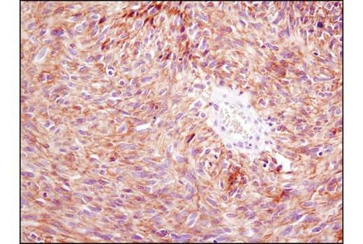 Immunohistochemistry Image 3: PDGF Receptor alpha (D13C6) Rabbit Monoclonal Antibody