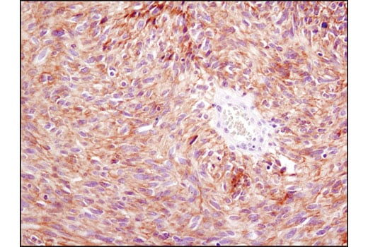 Immunohistochemistry Image 3: PDGF Receptor α (D13C6) XP<sup>®</sup> Rabbit mAb